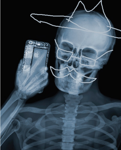 Performo xray